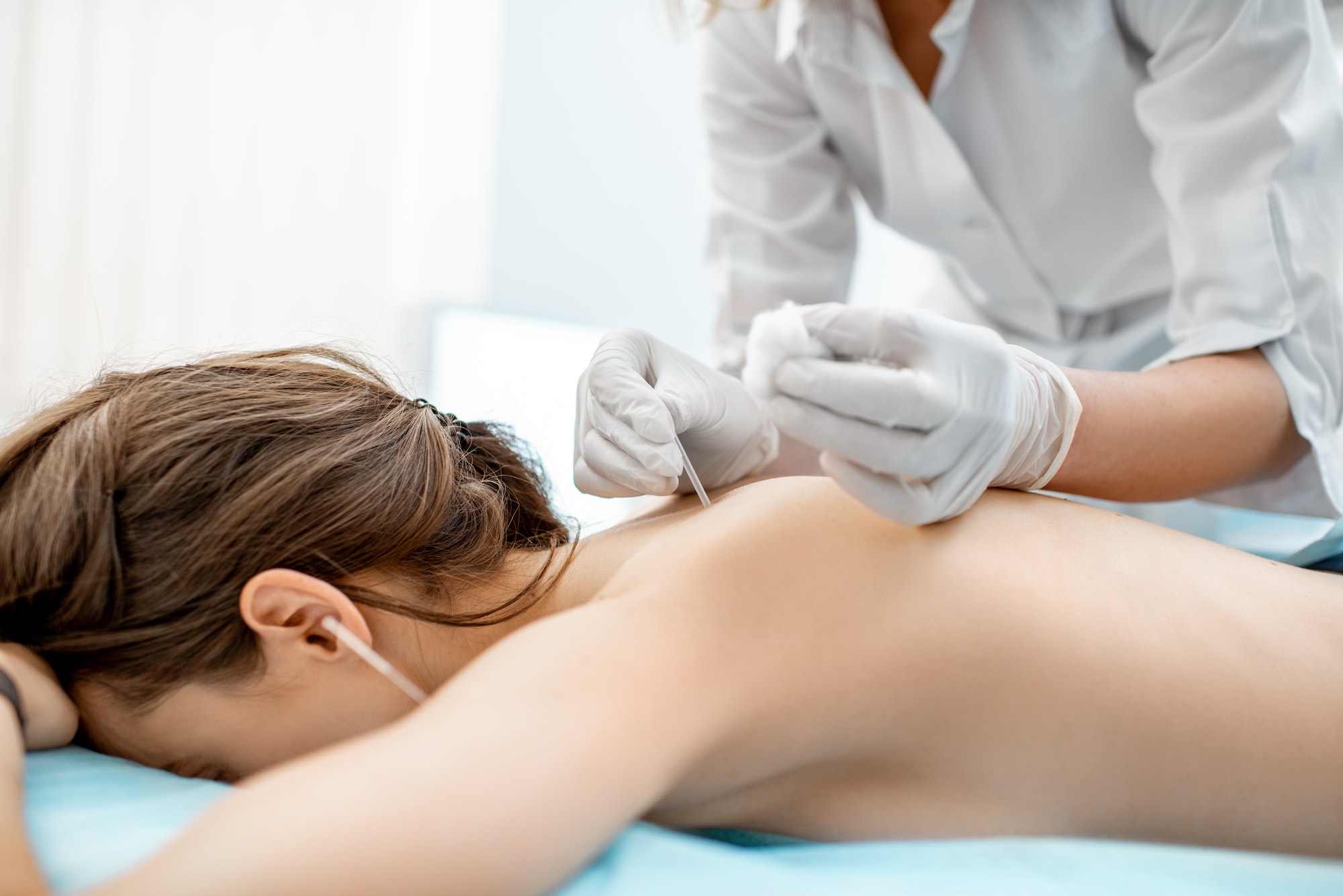 Acupuncture medical treatment